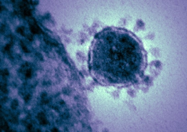 Particella di un Coronavirus vista al microscopio elettronico (fonte: National Institute of Health, NIH)